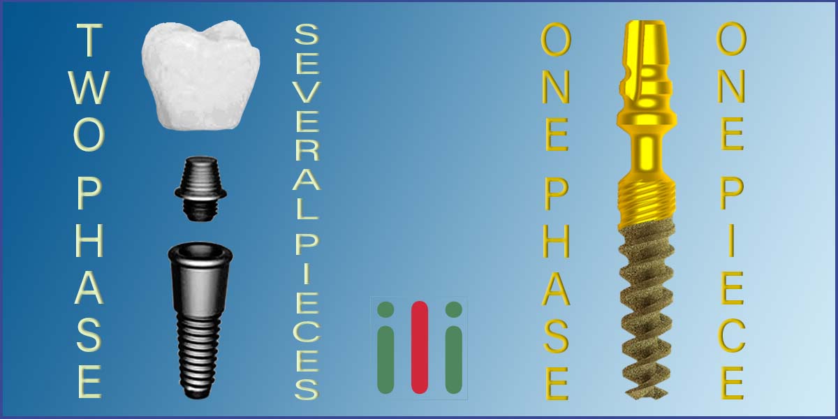Dental Implantation Methods - What is the difference Between Them?
