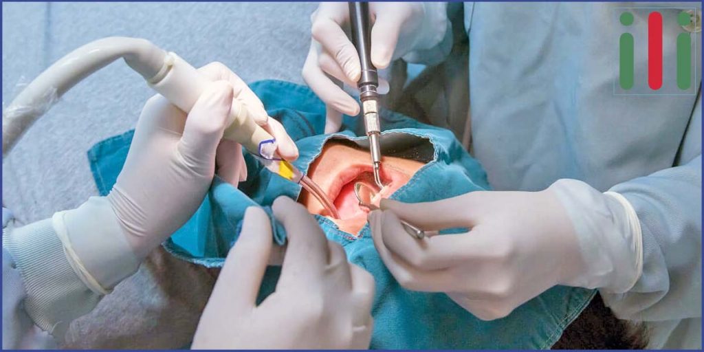 Szájsebészeti Beavatkozás, Hogyan Készüljek Fel (1. rész)