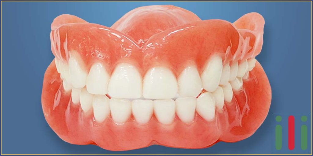 Hagyományos Műfogsor Problémák és Lehetséges Megoldások