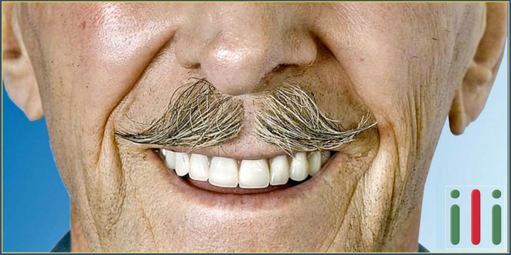 Teljes fogsor implantátummal a végleges megoldás