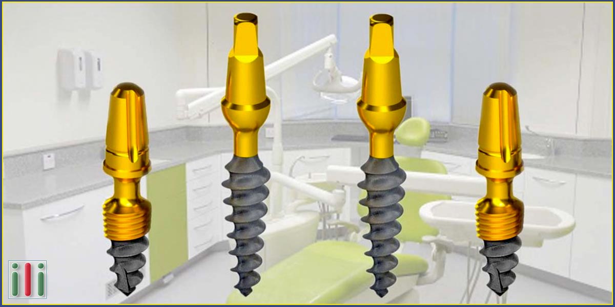 Immediate loading implants - Learn more about them