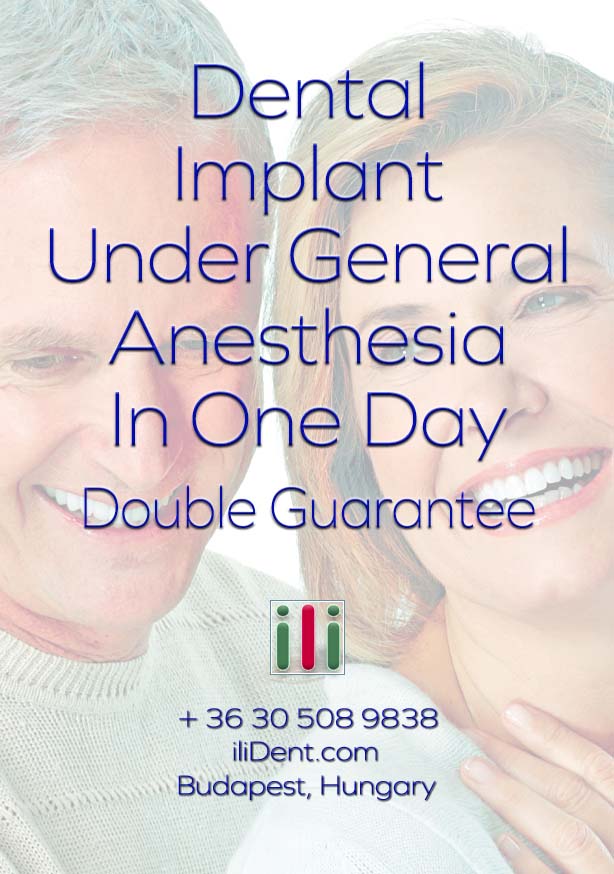 Dental implants under general anesthesia
