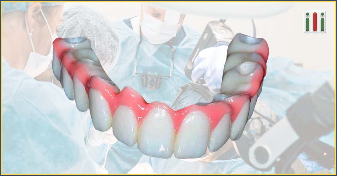 One-phase implant-based oral rehabilitation - How is it done?