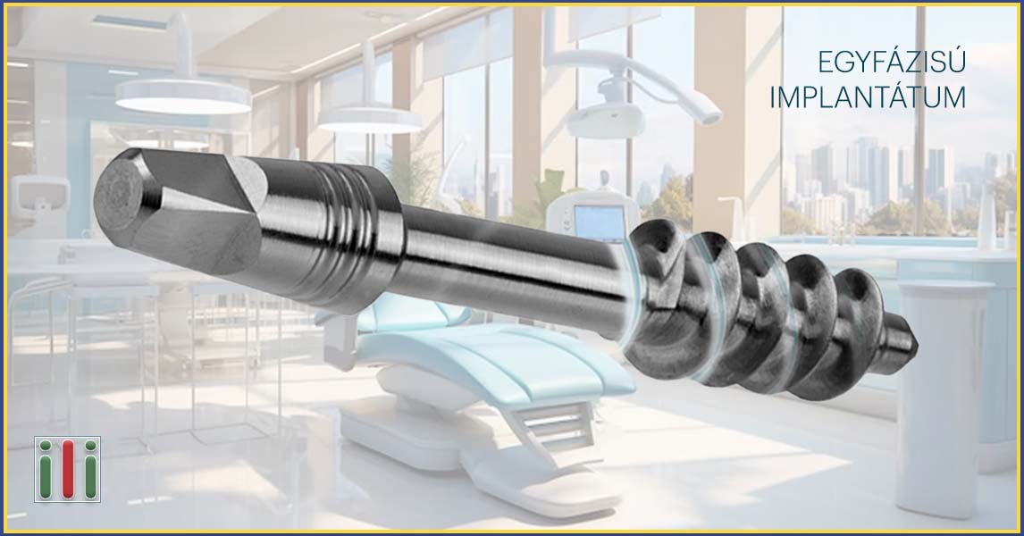 Egyfázisú implantátum beültetés, a gyors és hatékony fogpótlás