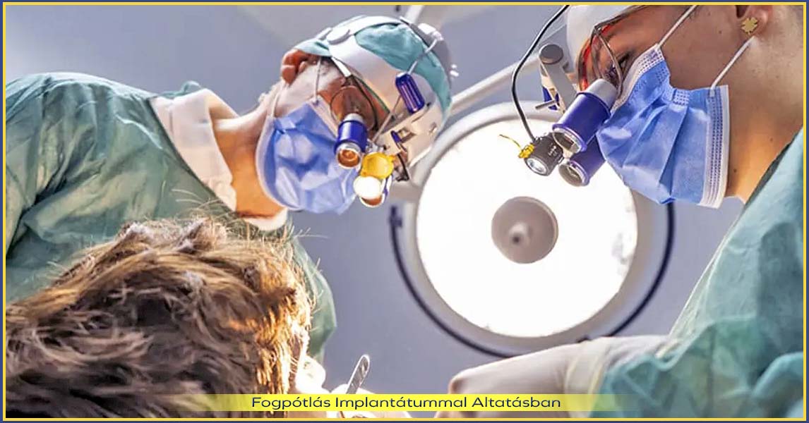 Az egyfázisú implantátum beültetés ár kedvezőbb lehet csomagáras konstrukcióban – biztonságos és átlátható megoldás a teljes szájrehabilitációra